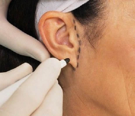 cirurgia na orelha em Curitiba